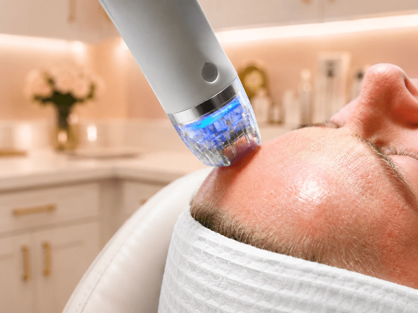 Radiofrequency Microneedling